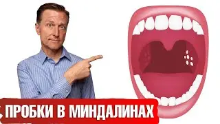 Гнойные пробки в миндалинах👉как предотвратить их появление