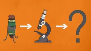 Invention and evolution of the microscope