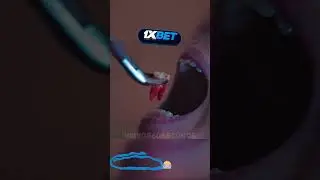 СТОМАТОЛОГ? А НЕТ СТАВЯТ ЖУЧОК В ЗУБ!  🤯 Игра в Кальмара 2 СЕЗОН #игравкальмара #2сезон #сериал