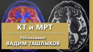 Что лучше МРТ или КТ при психиатрической диагностике? В чем разница между МРТ и КТ. Israclinic.