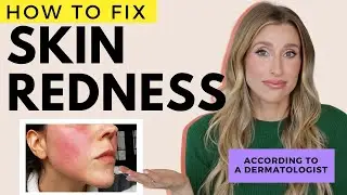 Fix Redness on the Face and Body | Dr. Sam Ellis