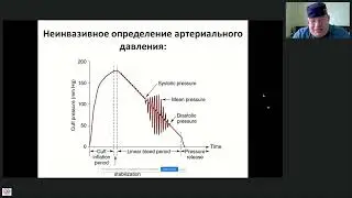 Мониторинг ГД при ЭКДТ Афончиков В.С.