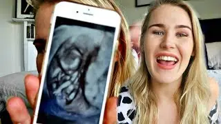 Pregnancy update | first trimester | ZOE YOUNG