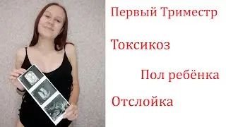 Мой Первый Триместр. Токсикоз. Угроза Прерывания Беременности. Пол Ребёнка.