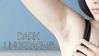 Dark underarms #darkunderarms #darkunderarm #darkskin #treatment #causes