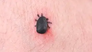 DEADLIEST TICK EVER!