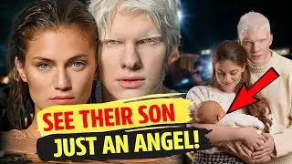 An Albino Man Got Married To A Georgian Model And Everyone Was Surprised When They Showed Their Baby