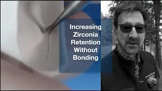 Removing a Zirconia Crown