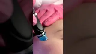 Глубокое очищение и увлажнение кожи без следов и реабилитации🔥