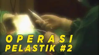 Operasi pelastik rekonstruksi | HALAL