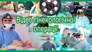 Видалення поліпу з вічка лівої маткової труби