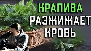 Крапива разжижает  кровь!!!