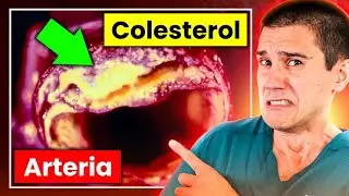 ¡ALERTA COLESTEROL!⚠️Cómo OPTIMIZAR sus NIVELES sin MODIFICAR tu DIETA