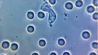 Нейтрофил фагоцитирует бактерию / Bacterial phagocytosis by neutrophil