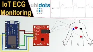 IoT Based ECG Monitoring with AD8232 ECG Sensor & ESP8266 on Ubidots