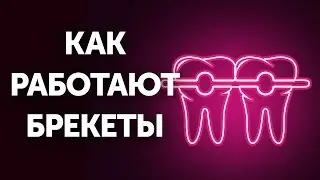 Как работают брекеты (и почему так медленно)