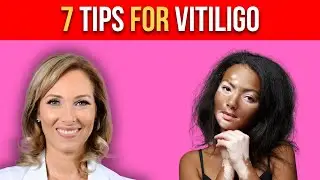7 TIPS FOR VITILIGO