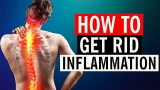 How To Get Rid of Inflammation in 2024