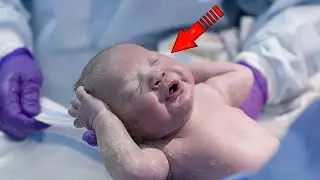 The obstetricians froze in amazement when they took the baby out of the mother's womb!
