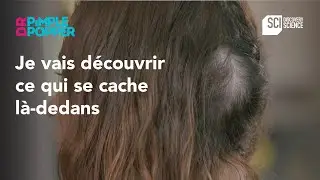 Je vais découvrir ce qui se cache là-dedans | Dr Pimple Popper