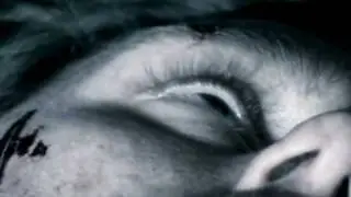 Worm in the nose