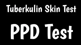 Tuberkulin Skin Test | PPD Skin Test | Mantoux Test | Diagnosis & Interpretation |