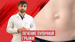 Пупочная грыжа. Лечение.