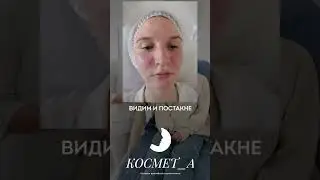 Отзыв пациента 