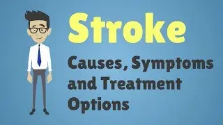 Stroke - Causes, Symptoms and Treatment Options