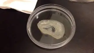 Human Ear Bioprinting