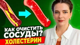 КАК СНИЗИТЬ ХОЛЕСТЕРИН? Как очистить сосуды от холестерина? Плохой и хороший холестерин (ЛПНП/ЛПВП)