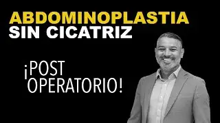 SIN RASTROS y SIN PROBLEMAS ¿Postoperatorio de una Abdominoplastia Sin Cicatriz? ► Dr John Garcia