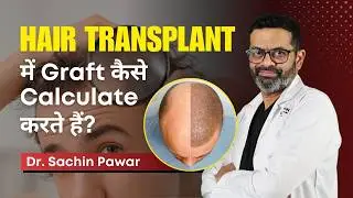 Hair Transplant में Graft कैसे Calculate करते हैं? | Grafts in Transplant Surgery | Dr Sachin Pawar