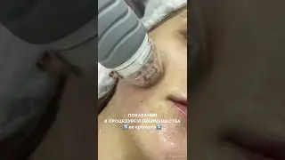 РФ-лифтинг для омоложения, уплотнения и улучшения качества качества кожи