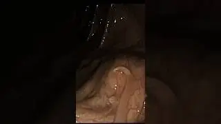 Жуткий мозговой паразит у Кеннеди 