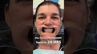 Before And After Nuvia's Permanent Teeth in 24-Hours! 🎉