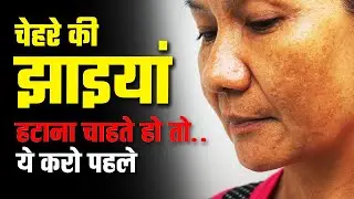 चेहरे को झाइयां (Melasma) हटाना चाहते हो तो ये करो पहले  : Jhaiya Kaise Hataye ghar pe 