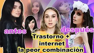 Eugenia Cooney La Influencer Más Delgada Empeora Por El Internet