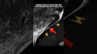 Human cells fuse & die upon infection by S*RS-C*V-2 