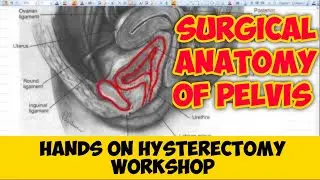 Hands on Hysterectomy Work shop - Theory Lecture 1 : Surgical Anatomy of Pelvis