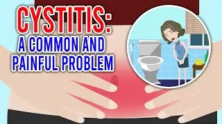 CYSTITIS: Its Causes, Symptoms, and Treatment