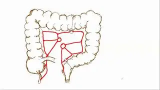 Анатомия толстой кишки. отделы и кровоснабжение