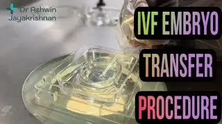 IVF | Embryo Transfer | ICSI | Dr Ashwin | malayalam video | kjk hospital | gynecology | kerala