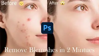 How to remove blemishes in photoshop