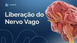 Técnica de liberação do nervo vago