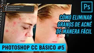 CÓMO ELIMINAR GRANOS DE ACNÉ CON PHOTOSHOP / PHOTOSHOP CC BÁSICO #5