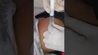 ازاي تعطي حقنة عضل لطفل عصبي How do you give an intramuscular injection to a  crazy child