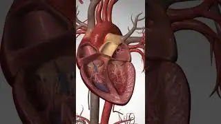 What happens during a Cardiac Arrest of the Heart 