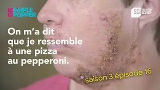 EPISODE 16 | Nævus néfaste | Dr Pimple Popper
