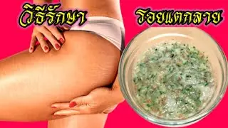 สูตรลดรอยแตกลาย​ Stretch mark reduction formula